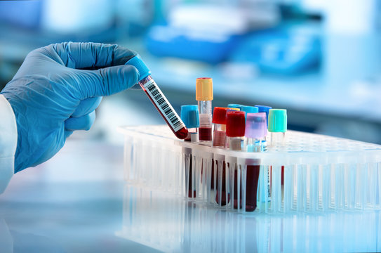 Laboratory Test